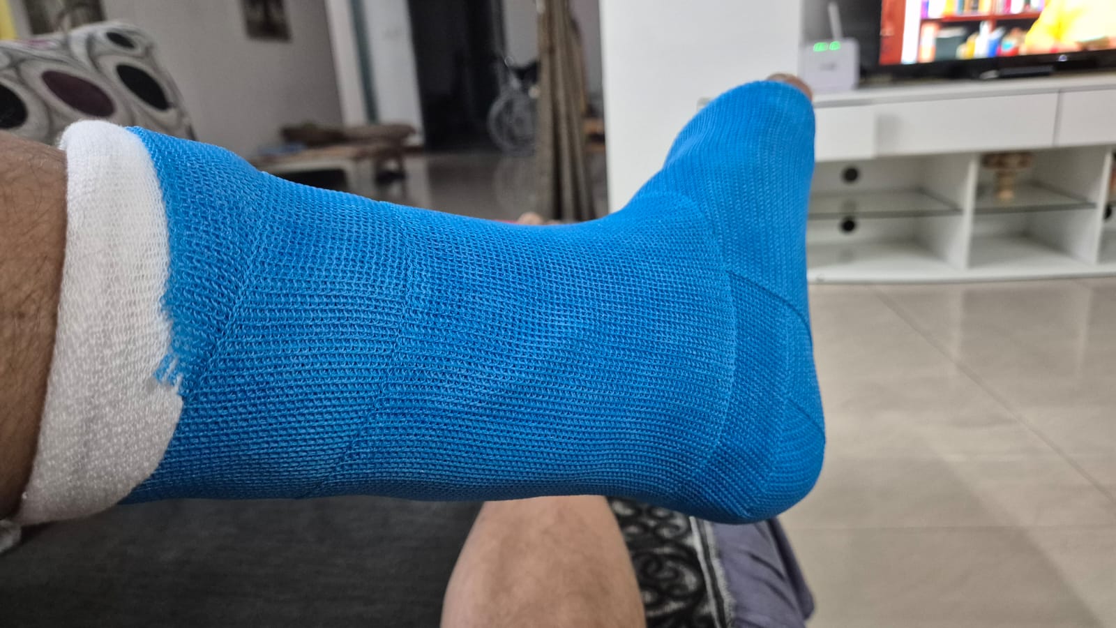 Plaster after ankle twist of CB Singh