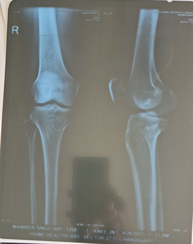 xray of preeti taken on 25th April 25